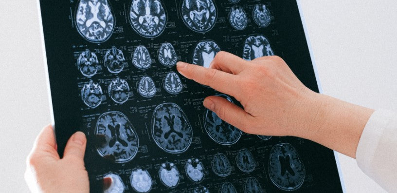 Keep Your Mind Sharp: The Top 4 Supplements to Support Cognitive Health