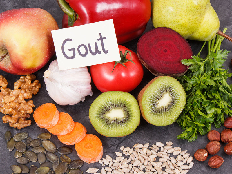 An assortment of gut health foods, featuring colorful fruits and vegetables